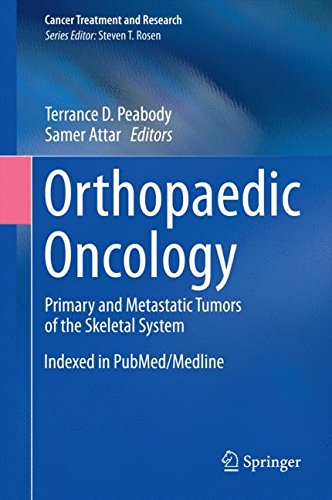 Orthopaedic Oncology: Primary and Metastatic Tumors of the Skeletal System (Cancer Treatment and Research)