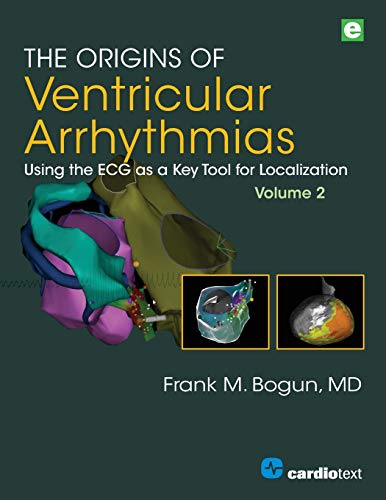 The Origins of Ventricular Arrhythmias, Volume 2: Using the ECG as a Key Tool for Localization, Volume 2