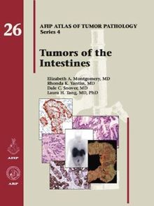 Montgomery, E: Tumors of the Intestines (AFIP Atlas of Tumor Pathology, Series 4,)
