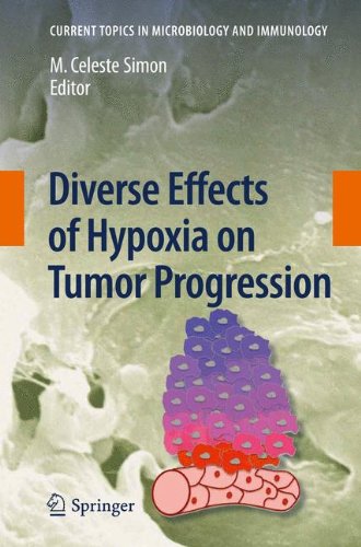 Diverse Effects of Hypoxia on Tumor Progression (Current Topics in Microbiology and Immunology)