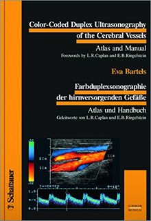 Color-Coded Duplex Ultrasonography of the Cerebral Vessels. Farbduplexsonographie der hirnversorgenden Gefässe: Atlas and Manual. Atlas und Handbuch. Eurobook-Bilingial (Bilingual/Eurobooks)