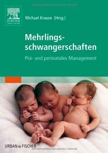 Mehrlingsschwangerschaften: Prä- und perinatales Management