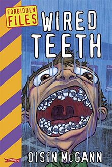 Wired Teeth (Forbidden Files)