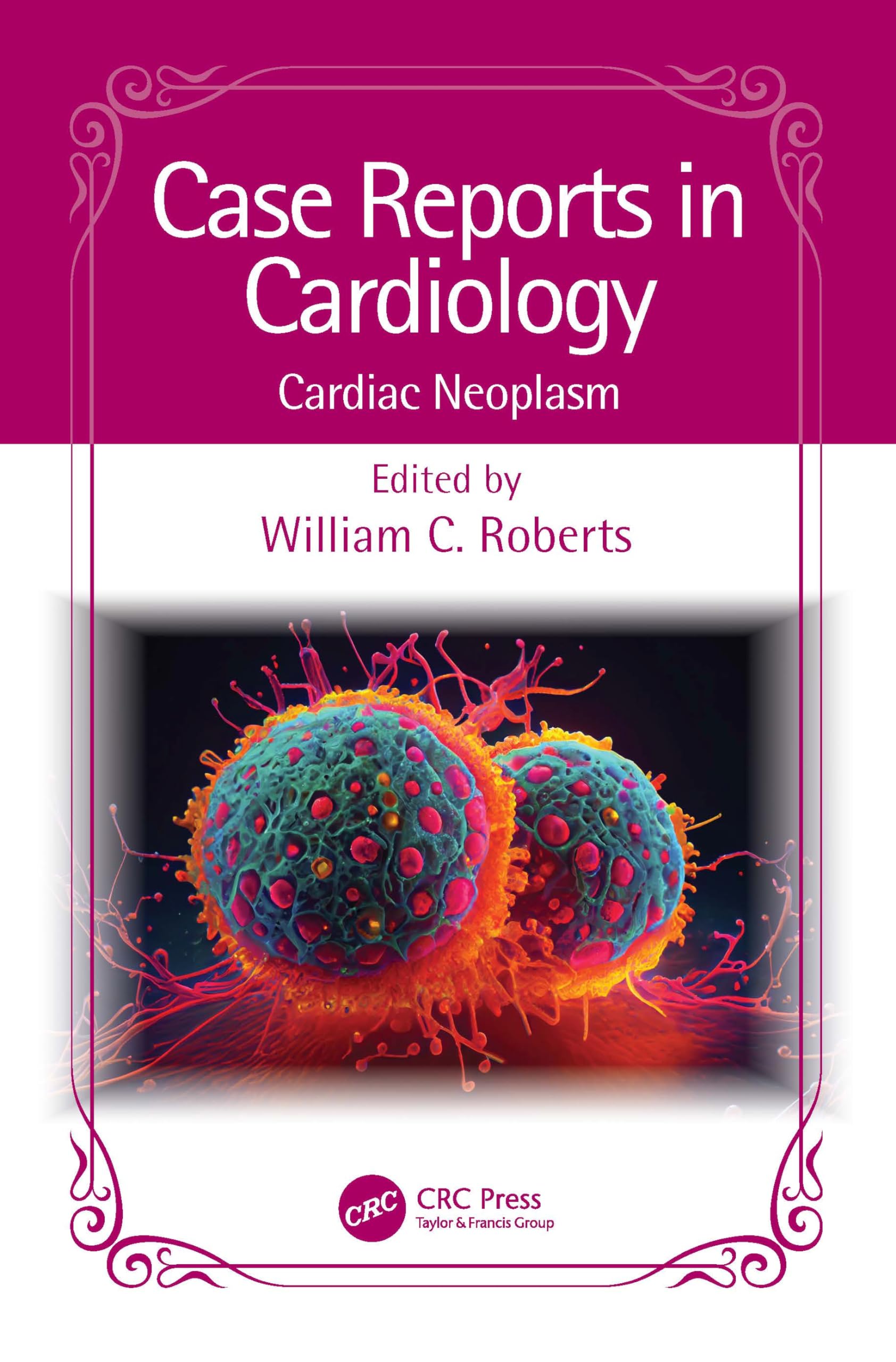 Case Reports in Cardiology: Cardiac Neoplasm