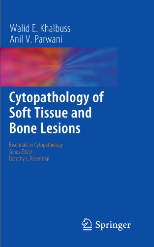 Cytopathology of Soft Tissue and Bone Lesions (Essentials in Cytopathology)