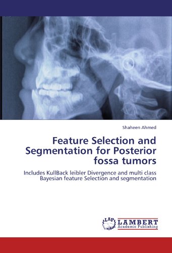 Feature Selection and Segmentation for Posterior fossa tumors: Includes KullBack leibler Divergence and multi class Bayesian feature Selection and segmentation