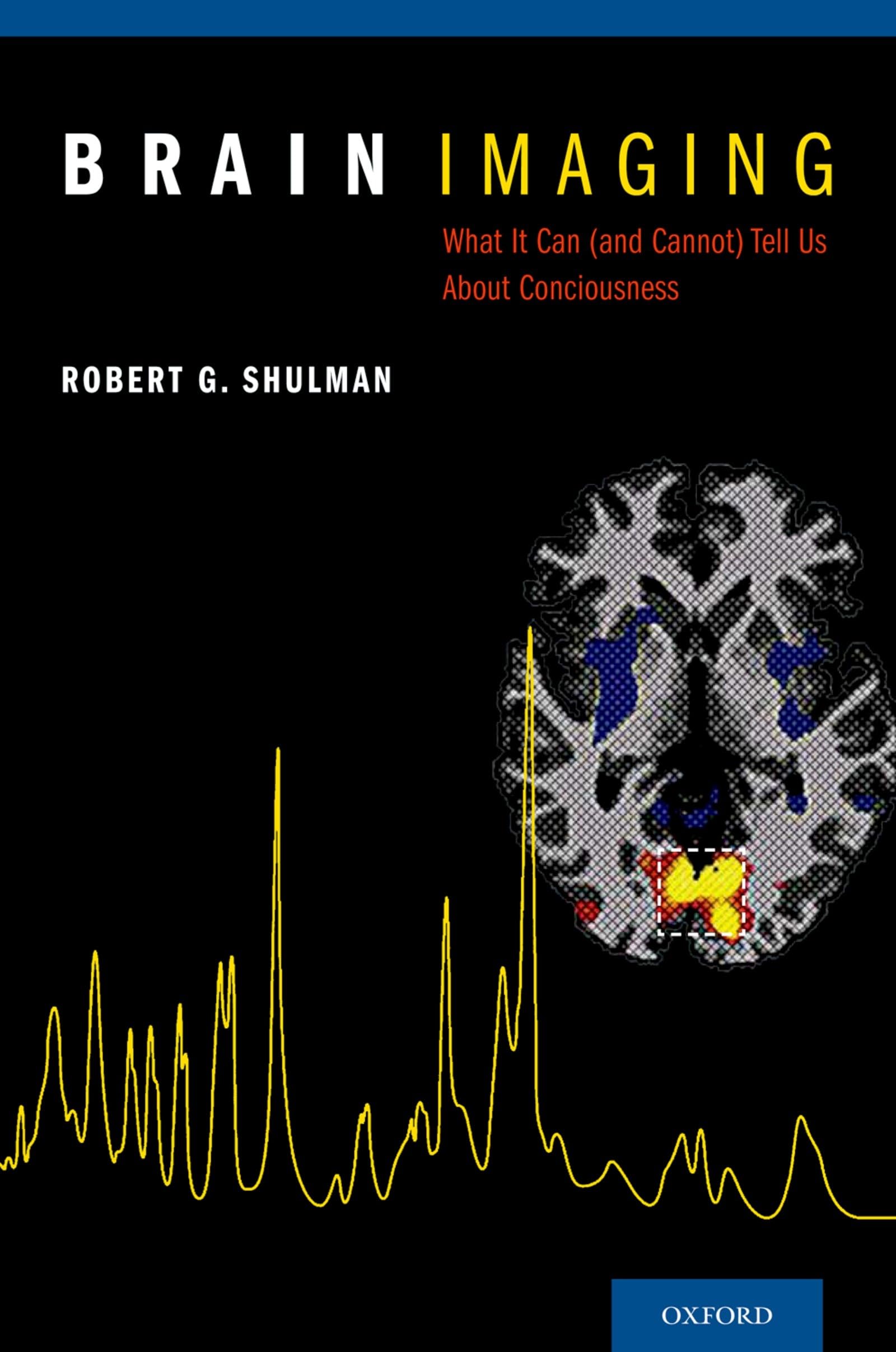 Brain Imaging: What It Can (and Cannot) Tell Us about Consciousness