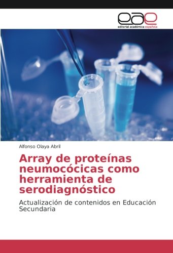 Array de proteínas neumocócicas como herramienta de serodiagnóstico: Actualización de contenidos en Educación Secundaria