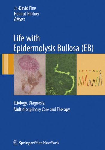 Life with Epidermolysis Bullosa (EB): Etiology, Diagnosis, Multidisciplinary Care and Therapy