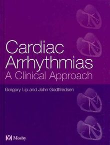 Cardiac Arrhythmias. A Clinical Approach