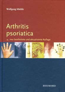 Arthritis psoriatika