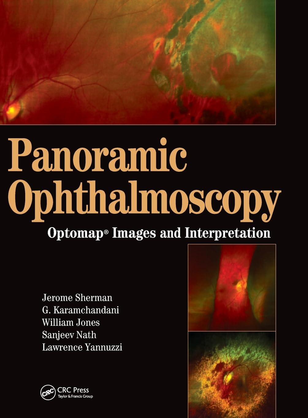 Panoramic Ophthalmoscopy: Optomap Images and Interpretation
