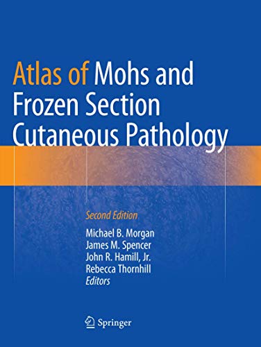 Morgan, Michael B. Atlas Of Mohs And Frozen Section Cutaneous Pathology