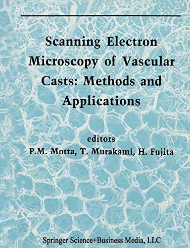 Scanning Electron Microscopy of Vascular Casts: Methods And Applications (Electron Microscopy In Biology And Medicine) (Electron Microscopy in Biology and Medicine, 10, Band 10)
