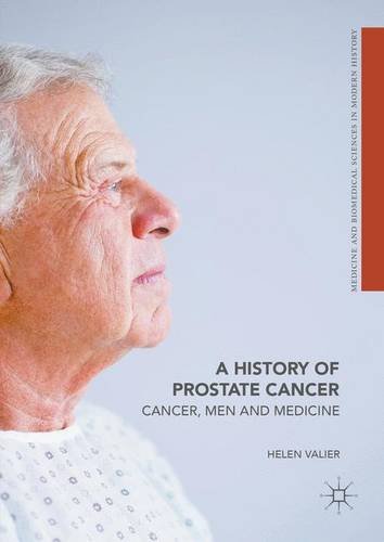 A History of Prostate Cancer: Cancer, Men and Medicine (Medicine and Biomedical Sciences in Modern History)