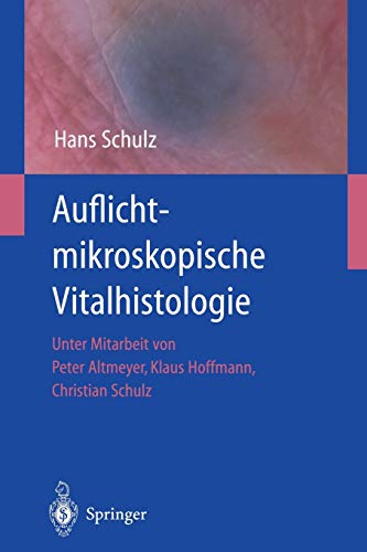 Auflichtmikroskopische Vitalhistologie: Dermatologischer Leitfaden (German Edition)