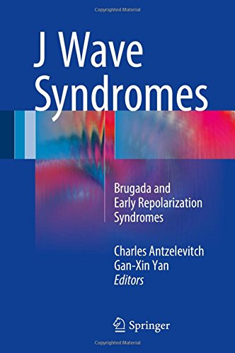 J Wave Syndromes: Brugada and Early Repolarization Syndromes