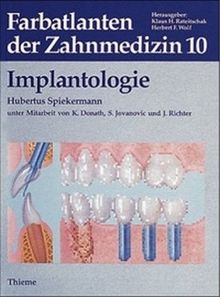 Farbatlanten der Zahnmedizin, Bd.10, Implantologie