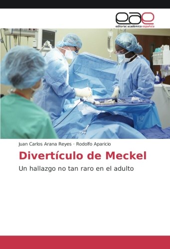 Divertículo de Meckel: Un hallazgo no tan raro en el adulto