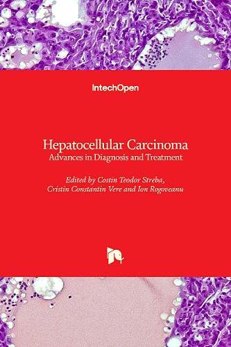Hepatocellular Carcinoma: Advances in Diagnosis and Treatment