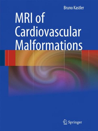 MRI of Cardiovascular Malformations