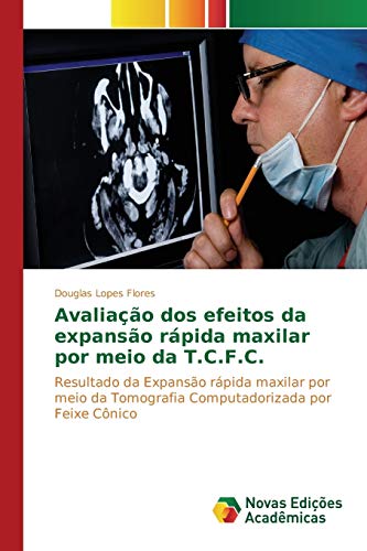 Avaliação dos efeitos da expansão rápida maxilar por meio da T.C.F.C.: Resultado da expansão rápida maxilar por meio da tomografia computadorizada por feixe cônico