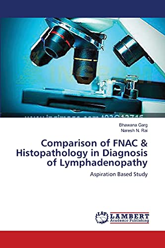 Comparison of FNAC & Histopathology in Diagnosis of Lymphadenopathy: Aspiration Based Study