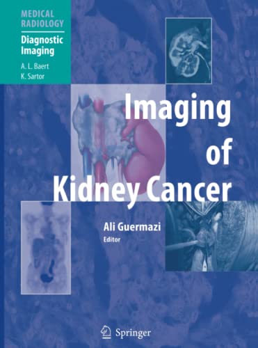 Imaging of Kidney Cancer (Medical Radiology)
