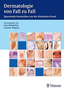 Dermatologie von Fall zu Fall: Spannende Kasuistiken aus der klinischen Praxis