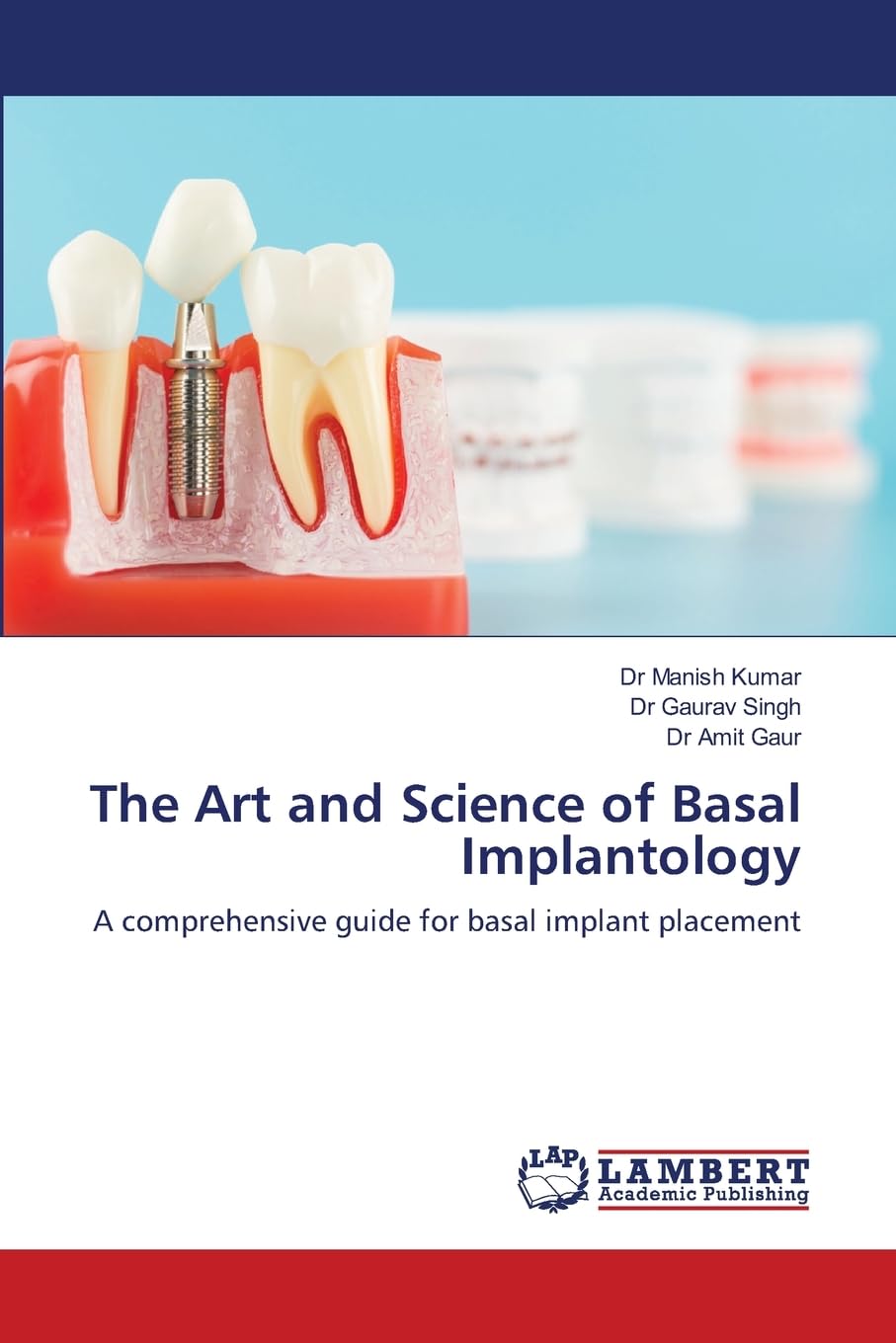 The Art and Science of Basal Implantology: A comprehensive guide for basal implant placement