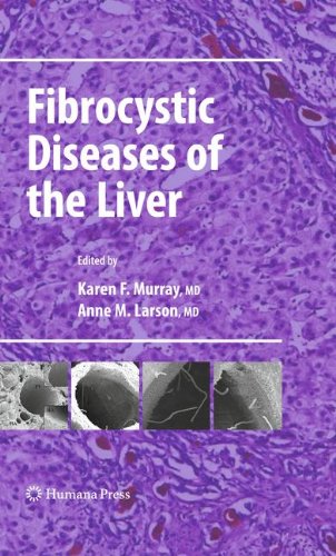 Fibrocystic Diseases of the Liver (Clinical Gastroenterology)