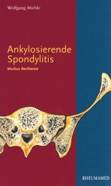 Ankylosierende Spondylitis: Morbus Bechterew | Buch | Zustand sehr gut