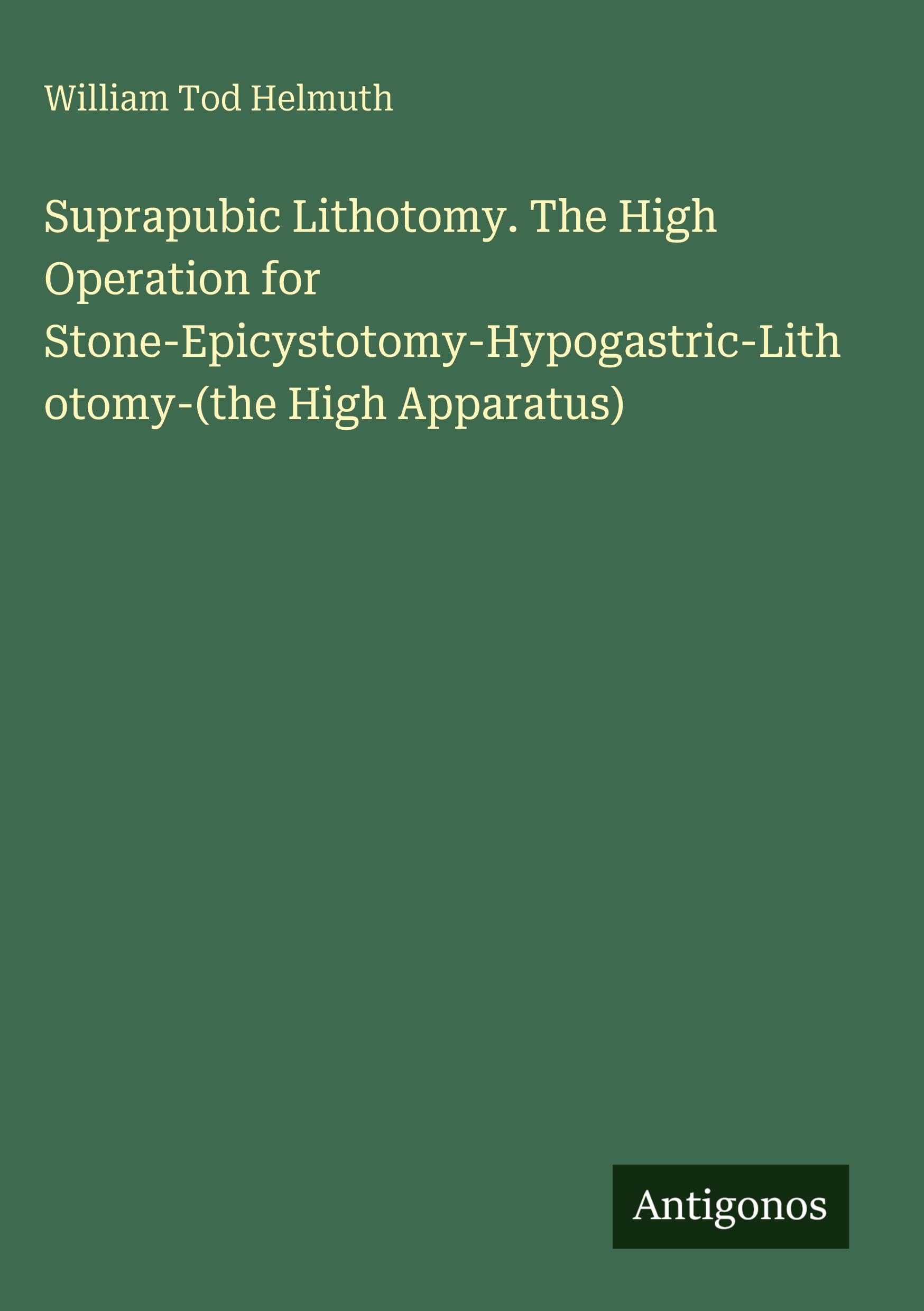 Suprapubic Lithotomy. The High Operation for Stone-Epicystotomy-Hypogastric-Lithotomy-(the High Apparatus)