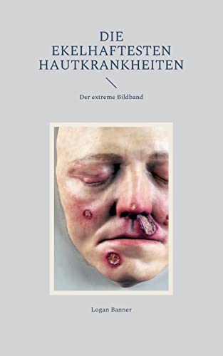 Die ekelhaftesten Hautkrankheiten: Der extreme Bildband
