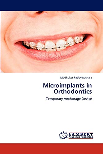 Microimplants in Orthodontics: Temporary Anchorage Device
