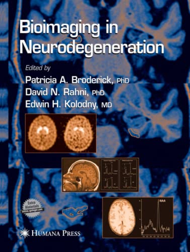 Bioimaging in Neurodegeneration (Contemporary Neuroscience)