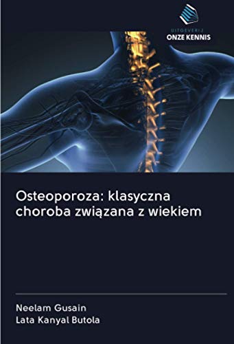 Osteoporoza: klasyczna choroba związana z wiekiem