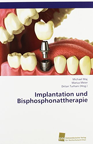 Implantation und Bisphosphonattherapie