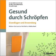 Gesund durch Schröpfen: Grundlagen und Anwendung