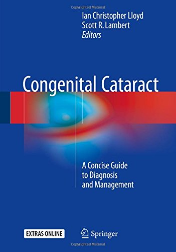 Congenital Cataract: A Concise Guide to Diagnosis and Management