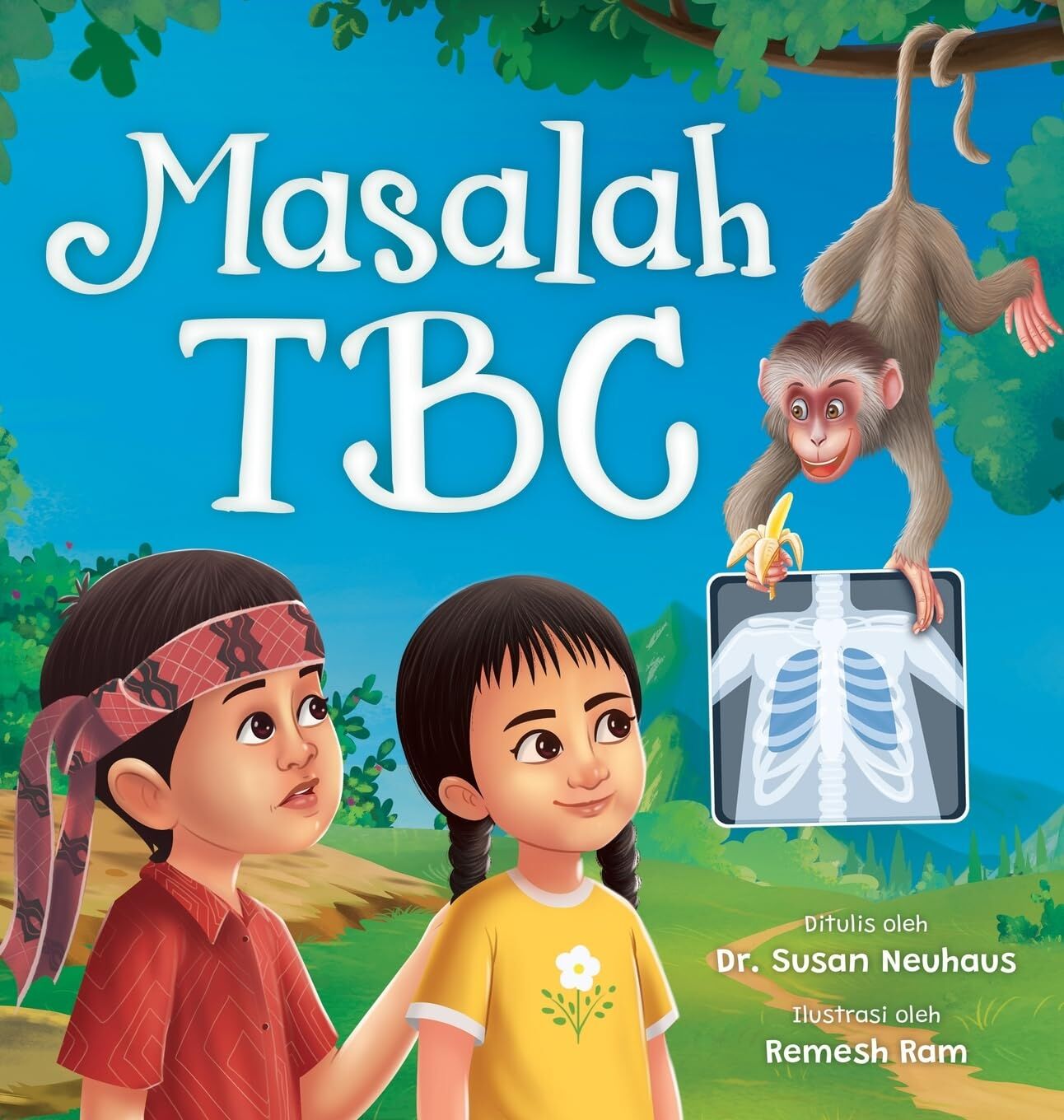 Masalah TBC