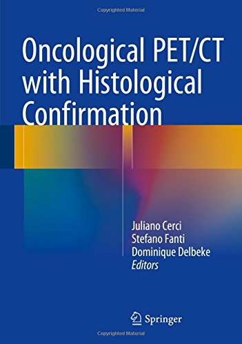 Oncological PET/CT with Histological Confirmation