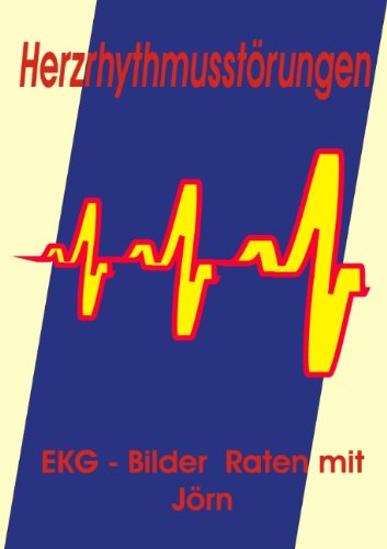 Herzrhythmusstörungen: EKG - Bilder Raten mit Jörn