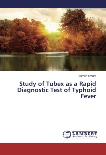 Study of Tubex as a Rapid Diagnostic Test of Typhoid Fever