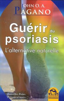 Guérir du psoriasis : l'alternative naturelle