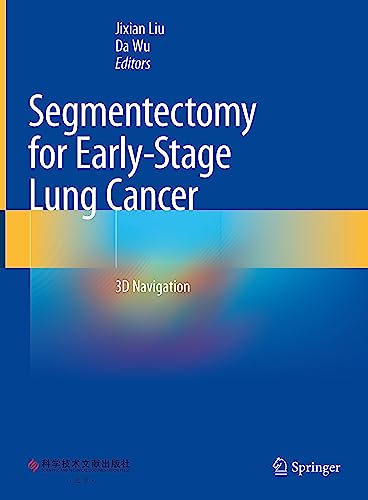 Segmentectomy for Early-Stage Lung Cancer: 3D Navigation