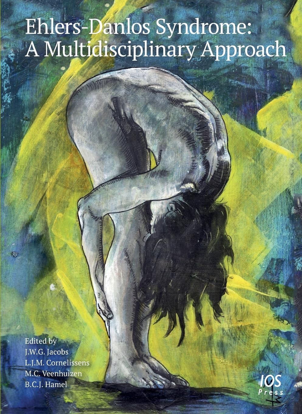 Ehlers-Danlos Syndrome