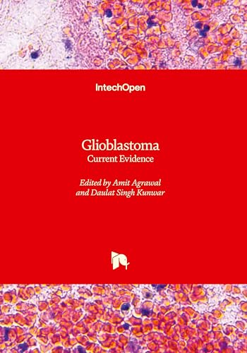 Glioblastoma: Current Evidence