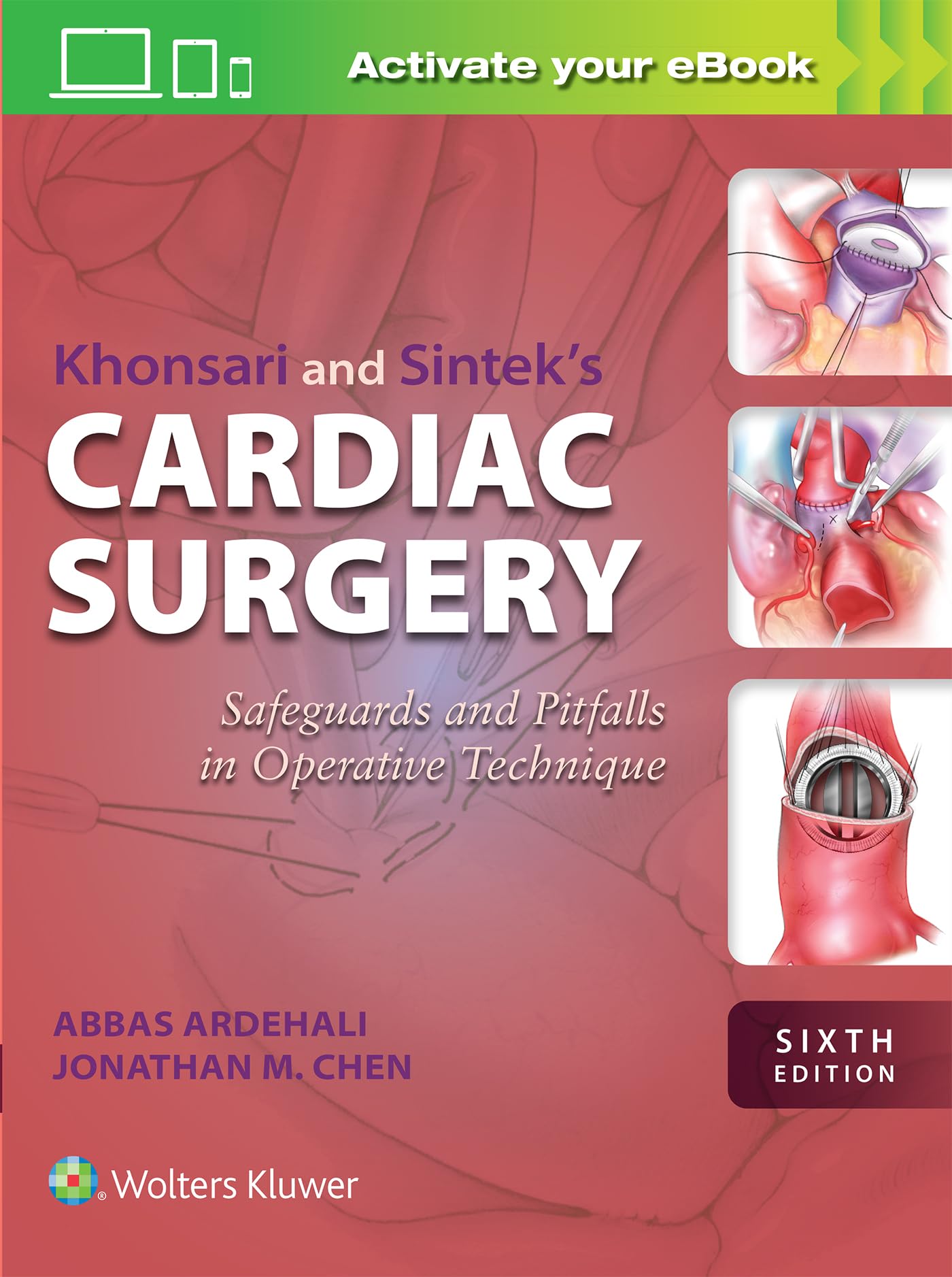 Khonsari and Sintek's Cardiac Surgery: Safeguards and Pitfalls in Operative Technique