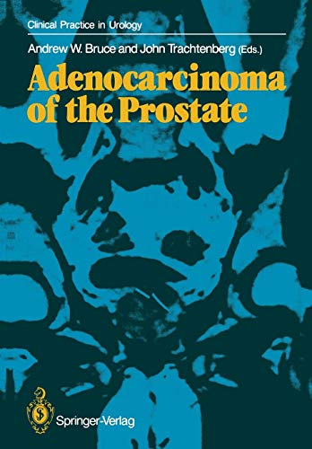 Adenocarcinoma of the Prostate (Clinical Practice in Urology)